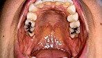 エロエロ専門トラベル科学生の歯観察 宮沢ちはる