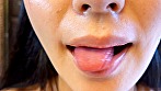 街角口内 10 画像3