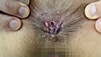 街角で声をかけてアナル観察させてもらう エッチで金欠な女の子 ゆりなちゃん - Image 16