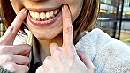 街角で声をかけて口内観察させてもらう オーガニックスーパー勤務 はつみちゃん - Image 3