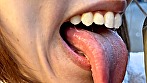 街角で声をかけて口内観察させてもらう オーガニックスーパー勤務 はつみちゃん - Image 7