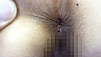 街角で声をかけてアナル観察させてもらう 食品工場事務員 みりなちゃん サンプル画像9