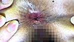 街角で声をかけてアナル観察させてもらう 食品工場事務員 みりなちゃん サンプル画像13