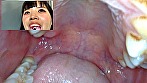 街角で声をかけて口内観察させてもらう コールセンターアルバイト あむちゃん 画像11
