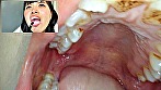 街角で声をかけて口内観察させてもらう コールセンターアルバイト あむちゃん 画像12