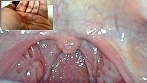 街角で声をかけて口内観察させてもらう コールセンターアルバイト あむちゃん 画像19
