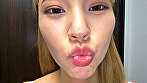 シーン2：健康優良口内！なつきちゃんの日内観察