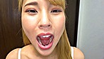 シーン5：健康優良口内！なつきちゃんの日内観察