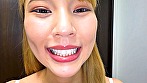 シーン8：健康優良口内！なつきちゃんの日内観察