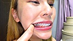 シーン10：健康優良口内！なつきちゃんの日内観察