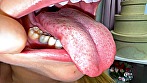 シーン12：健康優良口内！なつきちゃんの日内観察