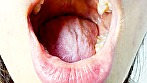 シーン1：ガチャ歯フェチ必見！高藤なほのちゃんの口内観察