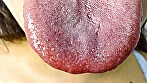 シーン3：ガチャ歯フェチ必見！高藤なほのちゃんの口内観察