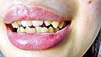 シーン10：ガチャ歯フェチ必見！高藤なほのちゃんの口内観察