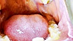 シーン14：ガチャ歯フェチ必見！高藤なほのちゃんの口内観察