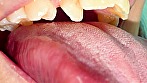 シーン12：食いしん坊なのに口内美人！弓山ゆきちゃんの口内観察