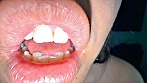 シーン14：口の開け方がエロすぎる逢坂瞳ちゃんの口内観察