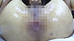 ベストオブアナル拡張 - Image 8
