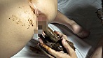 強制肛門こじ開け寝糞 高坂乃亜 サンプル画像12