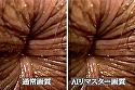 【AIリマスター】おしりの穴 おしりの穴編 画像12