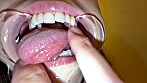 【個人撮影】横山夏希の喉チンコ触り＆肉厚舌を開口器で観察 画像9