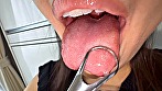 【個人撮影】原美織の舌ブラシで「汚舌苔」採取 - Image 5