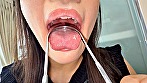【個人撮影】原美織の舌ブラシで「汚舌苔」採取 - Image 8