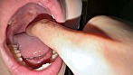 【個人撮影】音羽美鈴の喉チン触り＆開口器アヘ顔Wピース サンプル