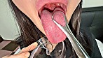 シーン8：【個人撮影】ゆうきすずの舌ブラシで「汚舌苔」採取