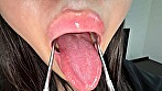 シーン15：【個人撮影】ゆうきすずの舌ブラシで「汚舌苔」採取