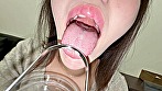 シーン13：【個人撮影】彩川ゆめ 舌ブラシで「汚舌苔」採取
