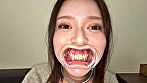 シーン14：【個人撮影】彩川ゆめの喉チン触り＆開口器Wピース