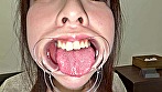 シーン16：【個人撮影】彩川ゆめの喉チン触り＆開口器Wピース