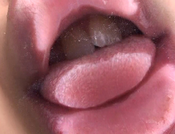 ベロチュウ 5 画像18