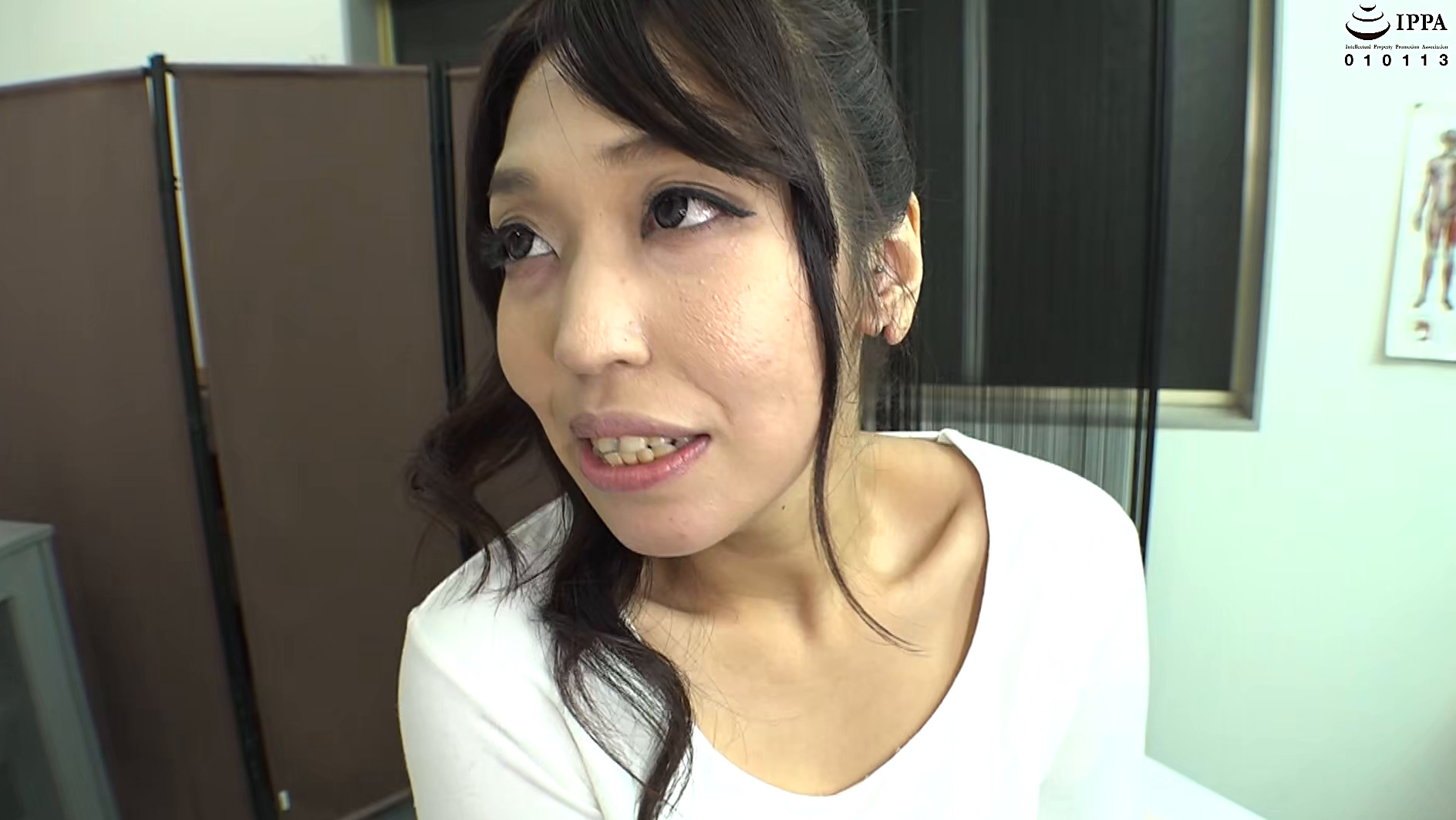 スカレズ 画像5