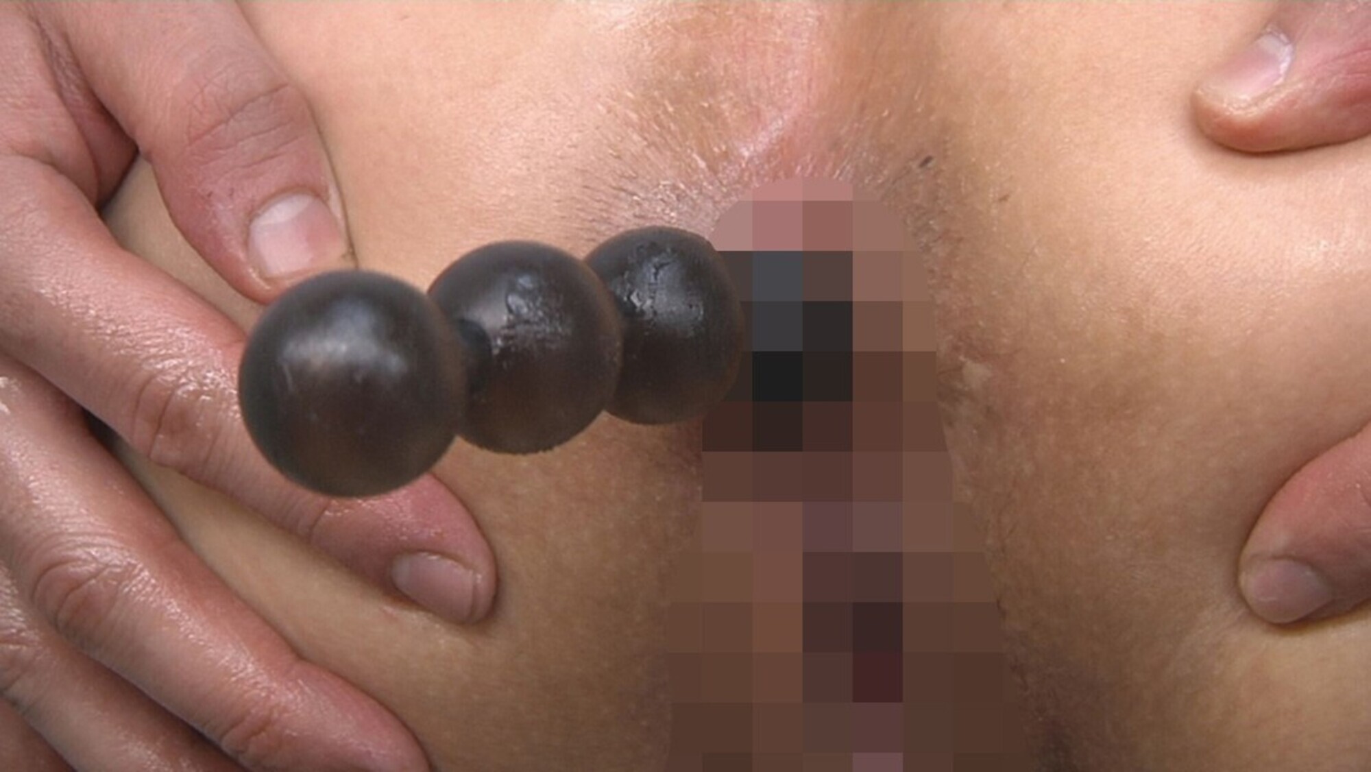 肛門ビッチが通うアナル拡張クリニック 画像7