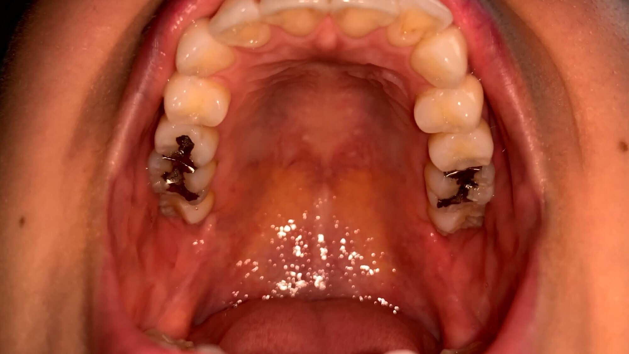 エロエロ専門トラベル科学生の歯観察 宮沢ちはる 画像3