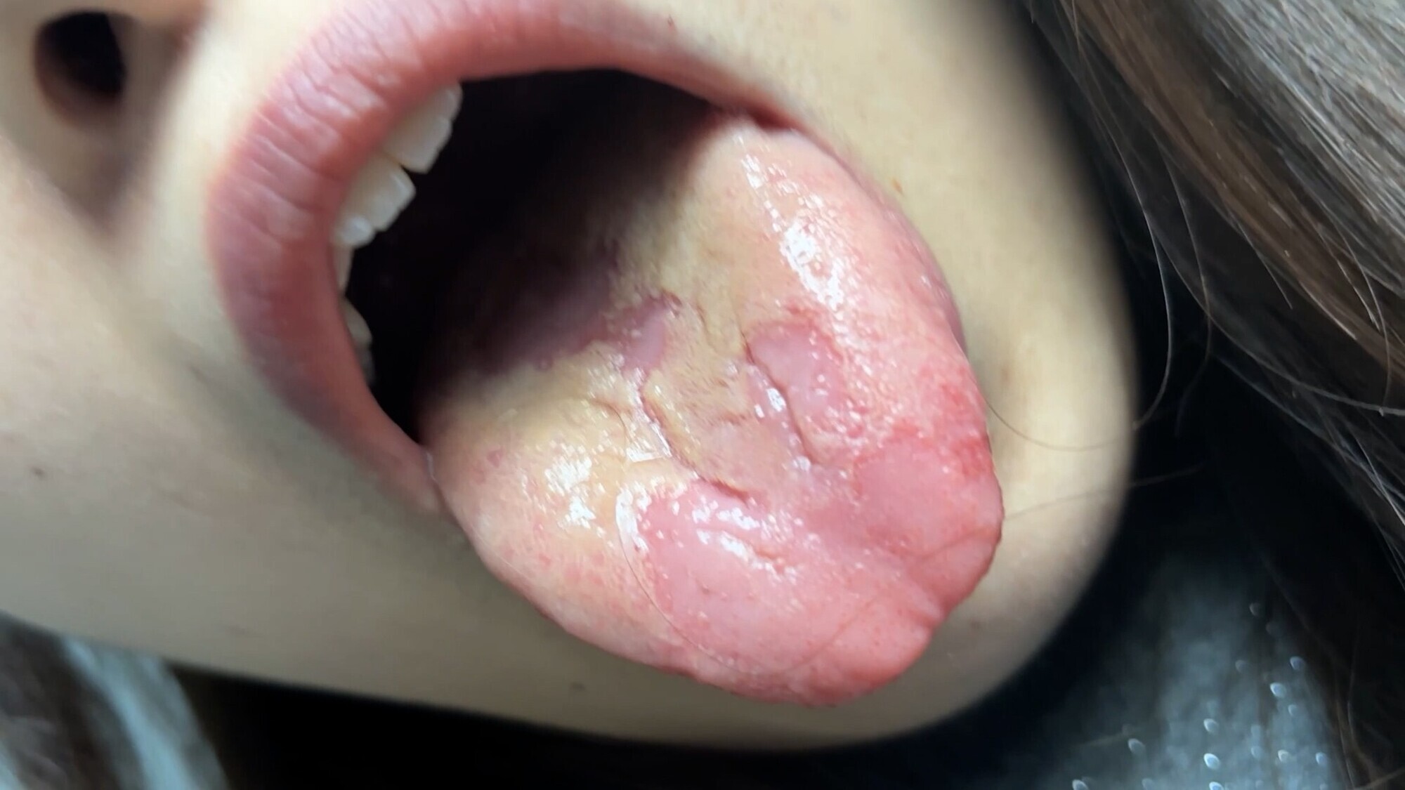 街角で声をかけて口内観察させてもらう 大学生 ゆゆちゃん 画像18