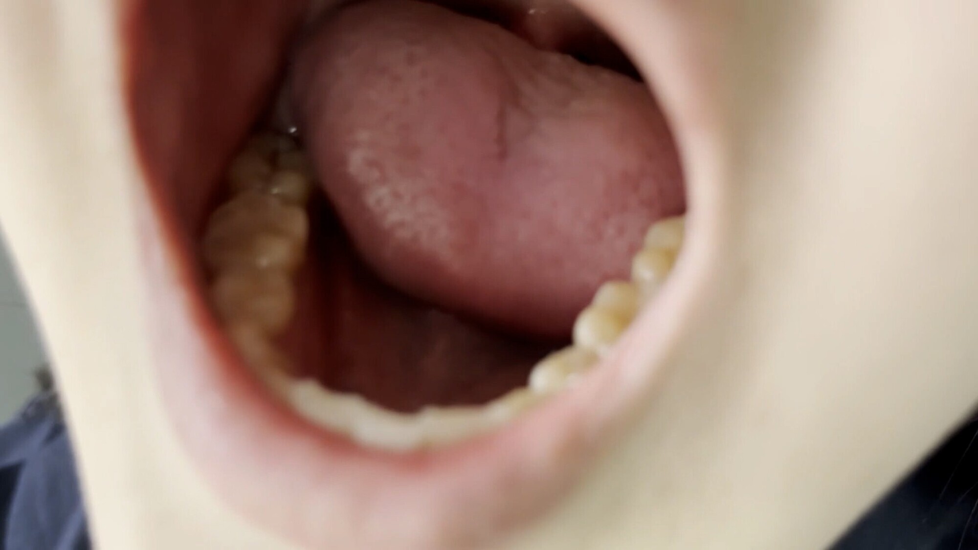 【特価】口腔観察 VOL.3 4名59分お買い得セット 6枚目