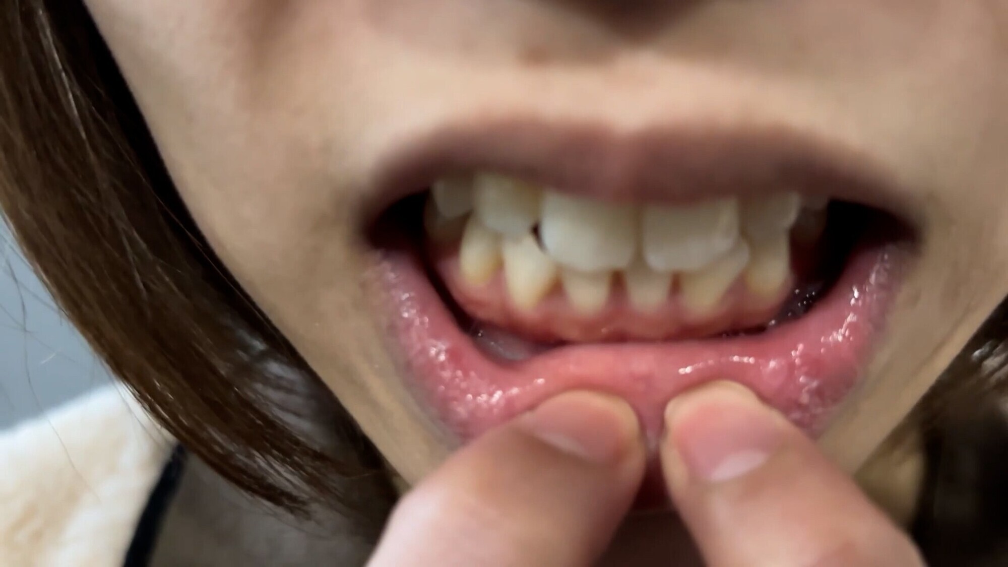 【特価】口腔観察 VOL.3 4名59分お買い得セット 13枚目