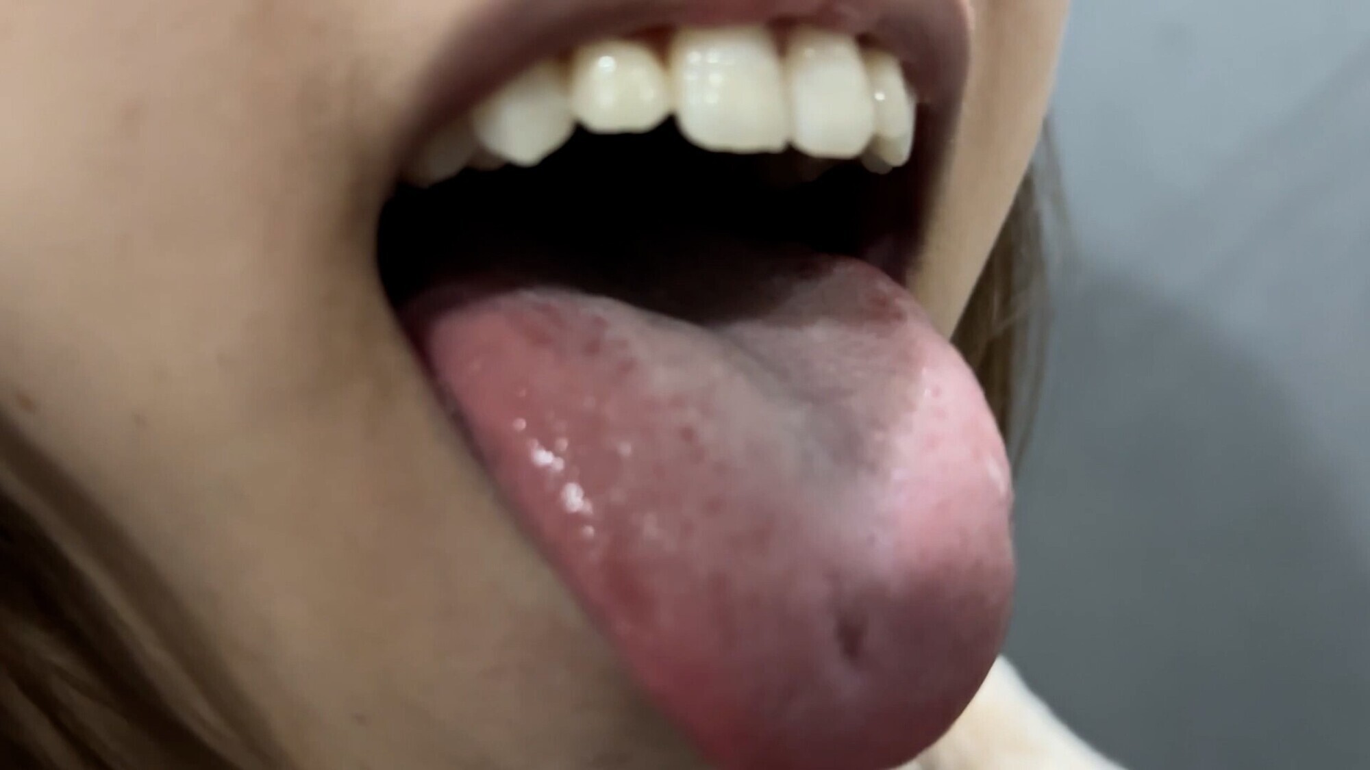 【特価】口腔観察 VOL.3 4名59分お買い得セット 15枚目