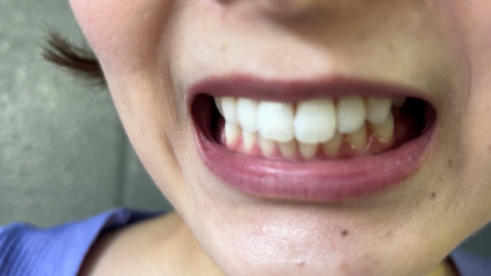 【特価】口腔観察 VOL.3 4名59分お買い得セット 18枚目