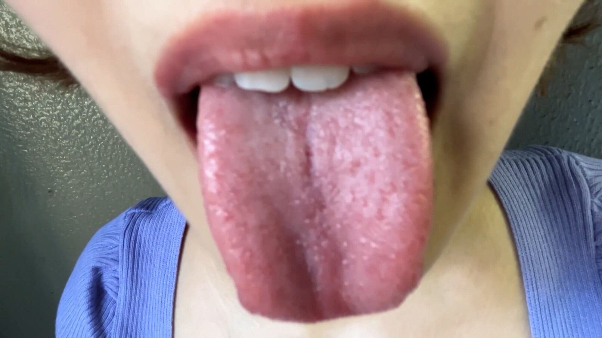 【特価】口腔観察 VOL.3 4名59分お買い得セット 19枚目