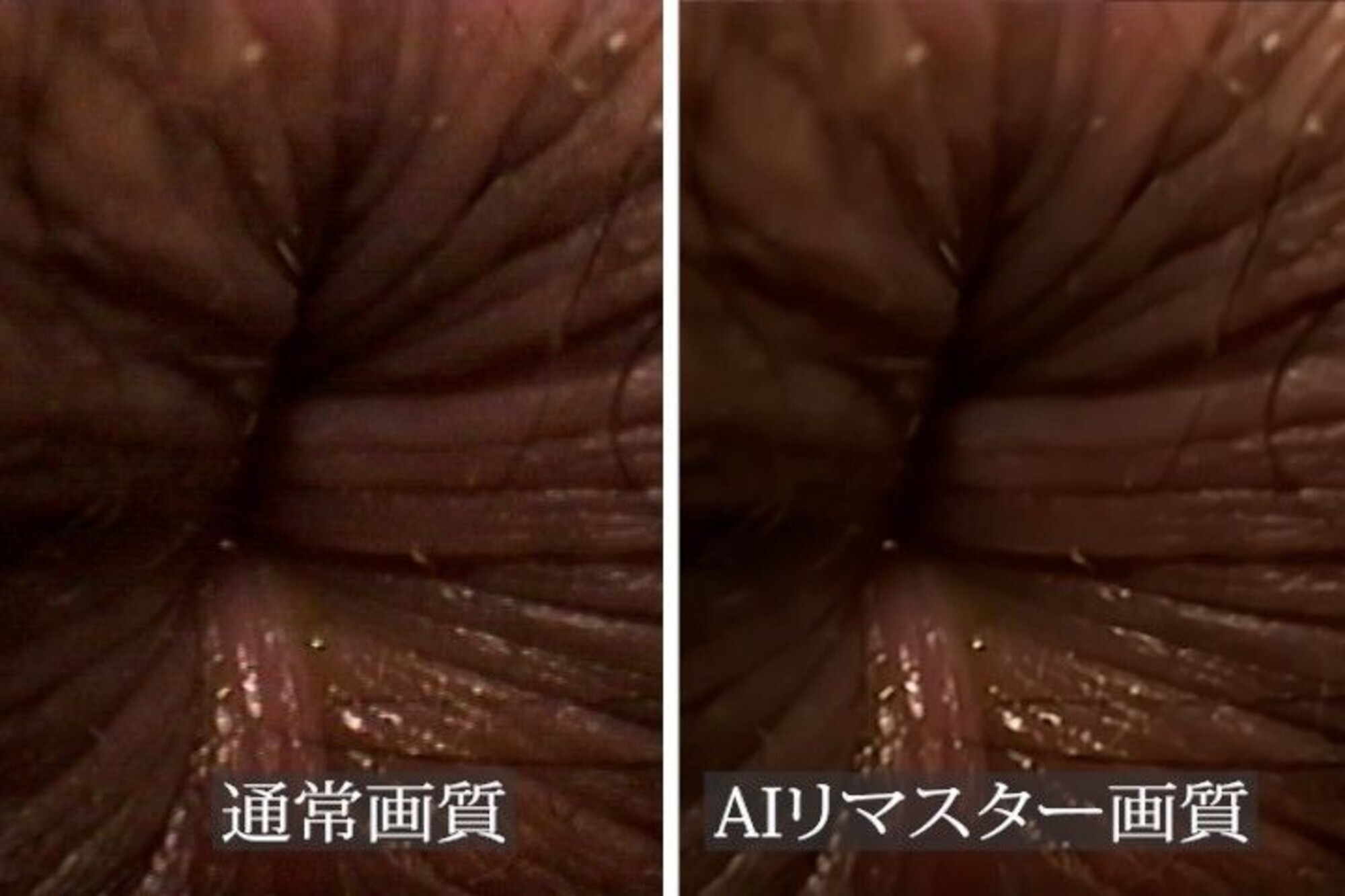 【AIリマスター】おしりの穴 おしりの穴編