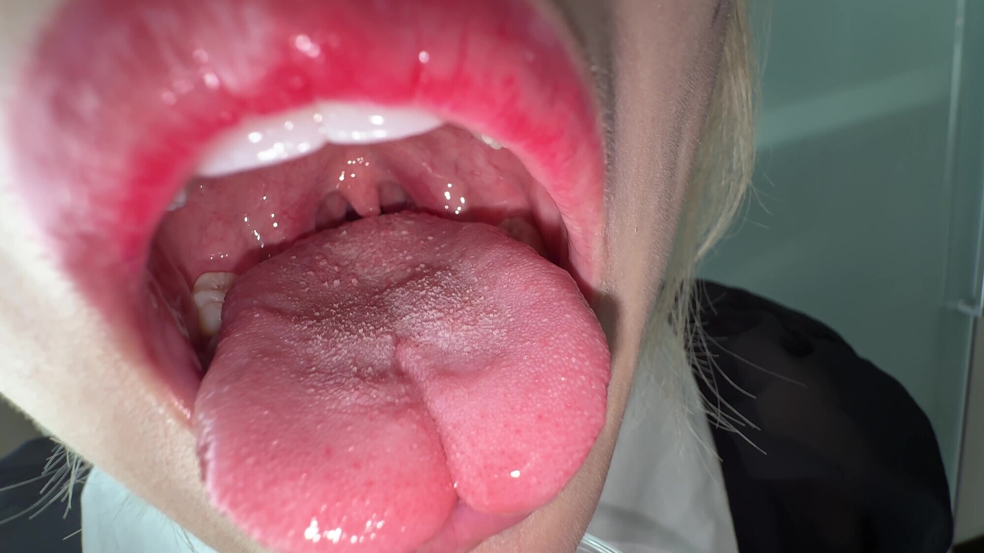 【個人撮影】安堂はるの 舌ブラシで「汚舌苔」採取 画像8