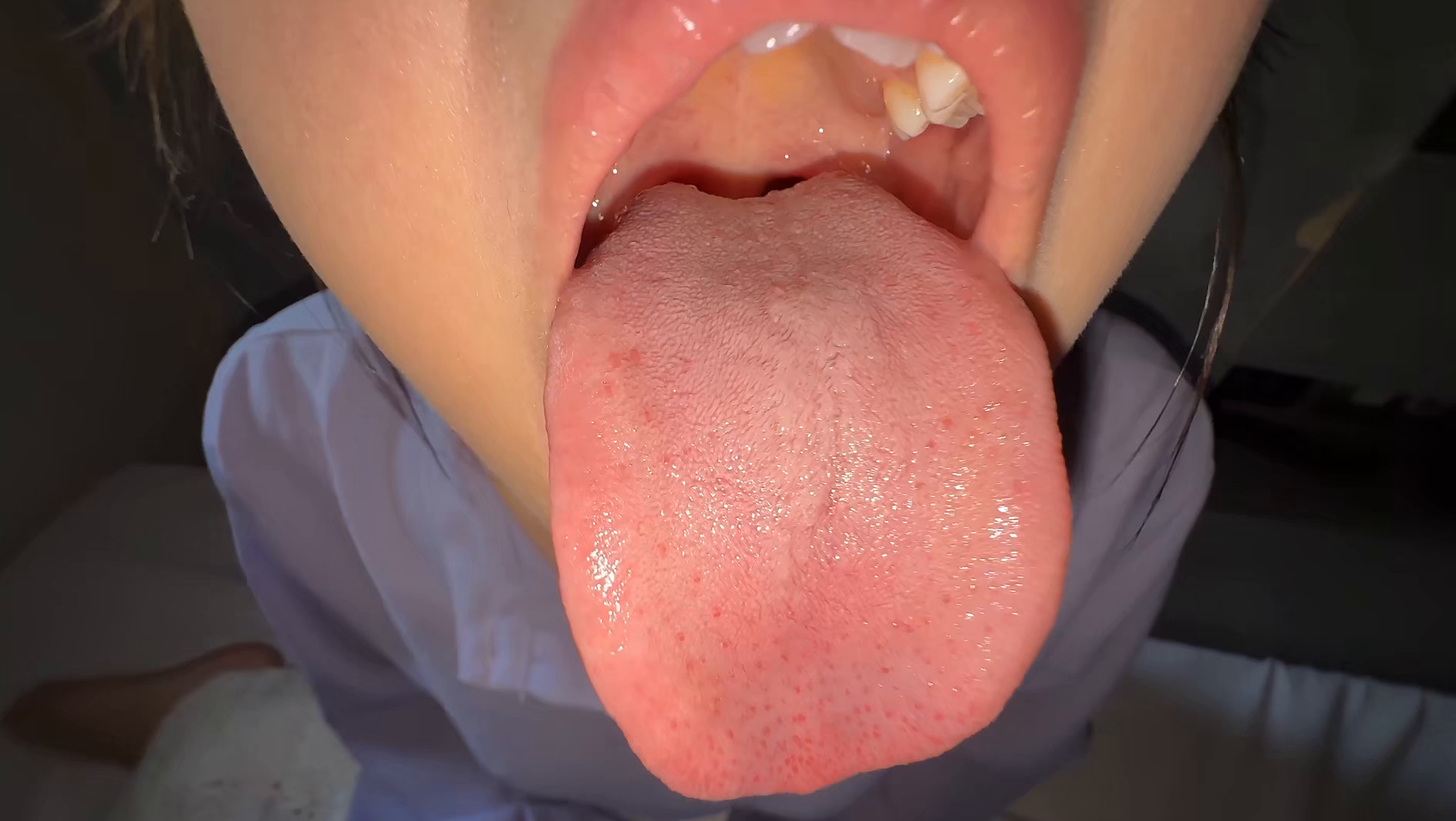 【個人撮影】谷田かりなの舌ブラシで「汚舌苔」採取 画像2