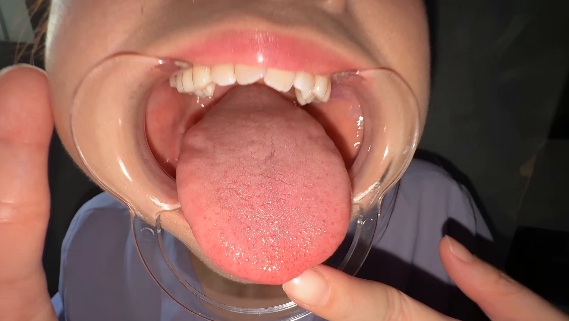 【個人撮影】谷田かりな 開口器で口内観察デカ舌を要チェック 画像10