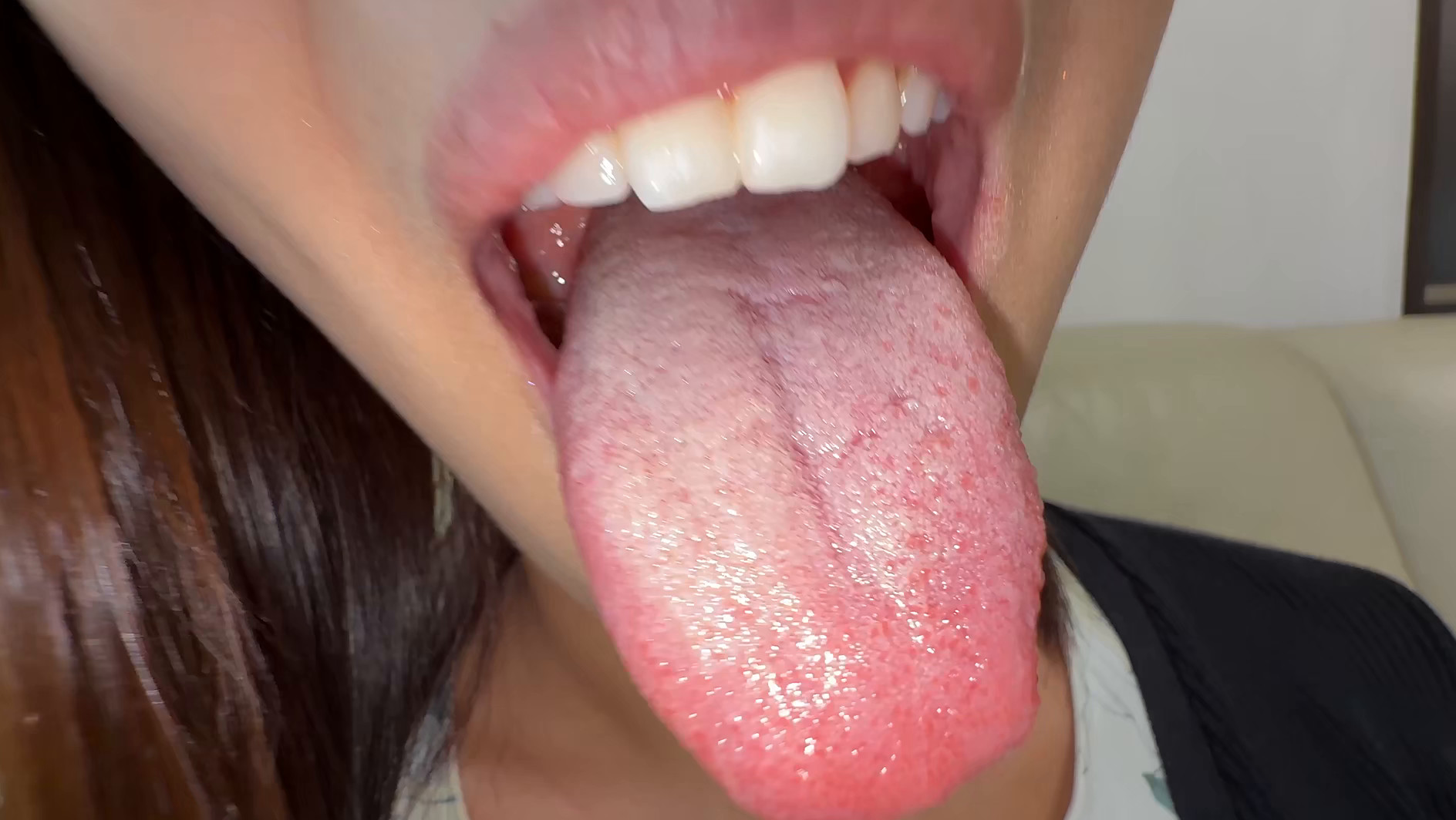 【個人撮影】旭メイサの舌ブラシで「汚舌苔」採取