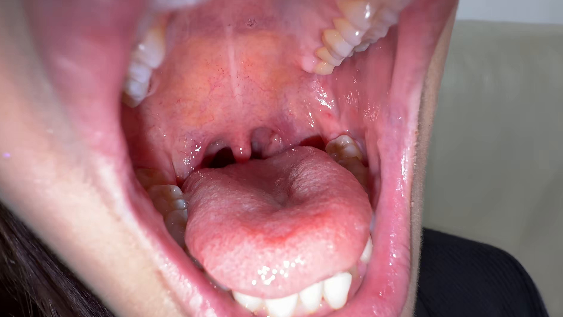 【個人撮影】旭メイサの喉チンコいじり 画像4