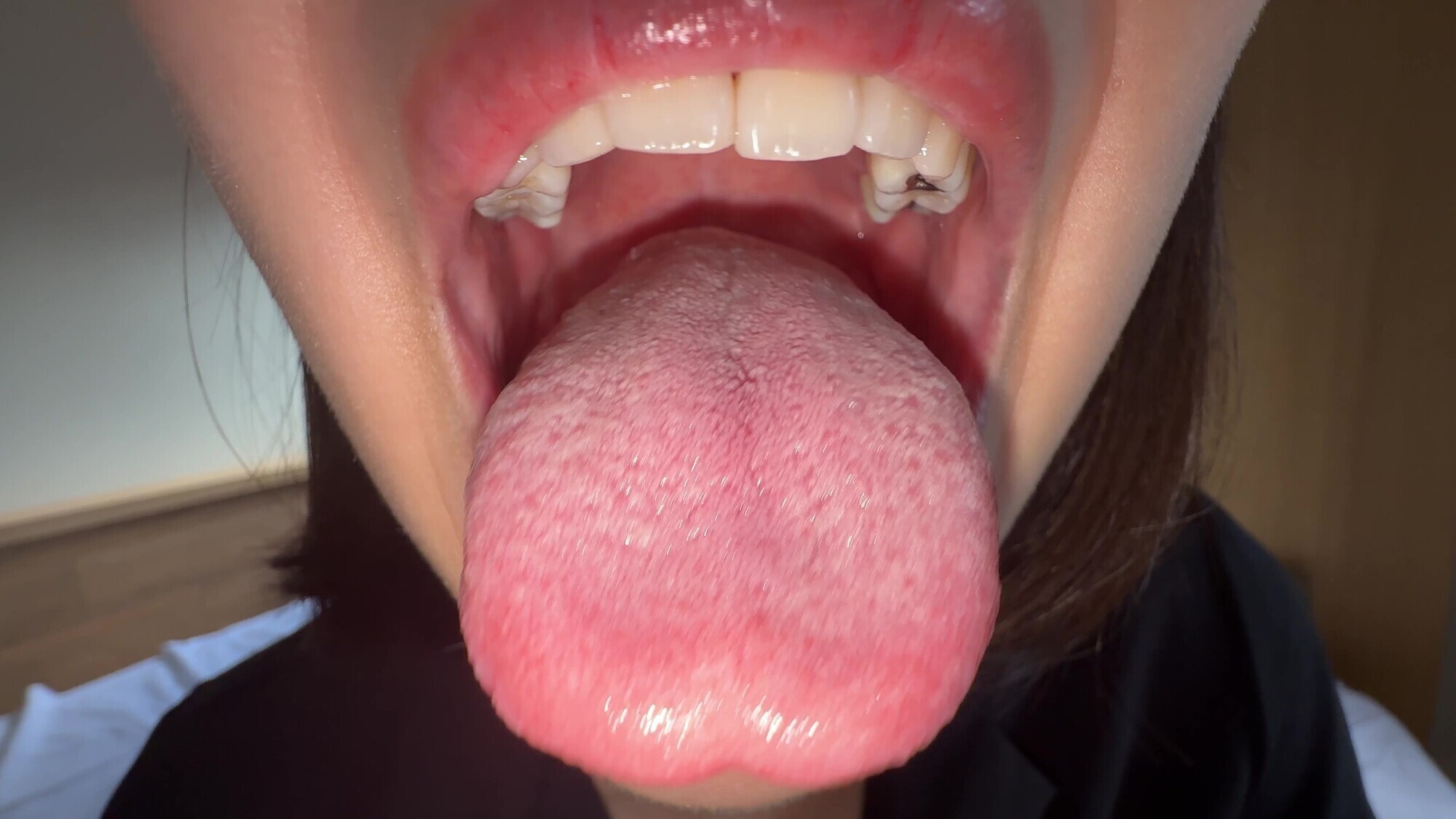 【個人撮影】湊波流の舌ブラシで「汚舌苔」採取！